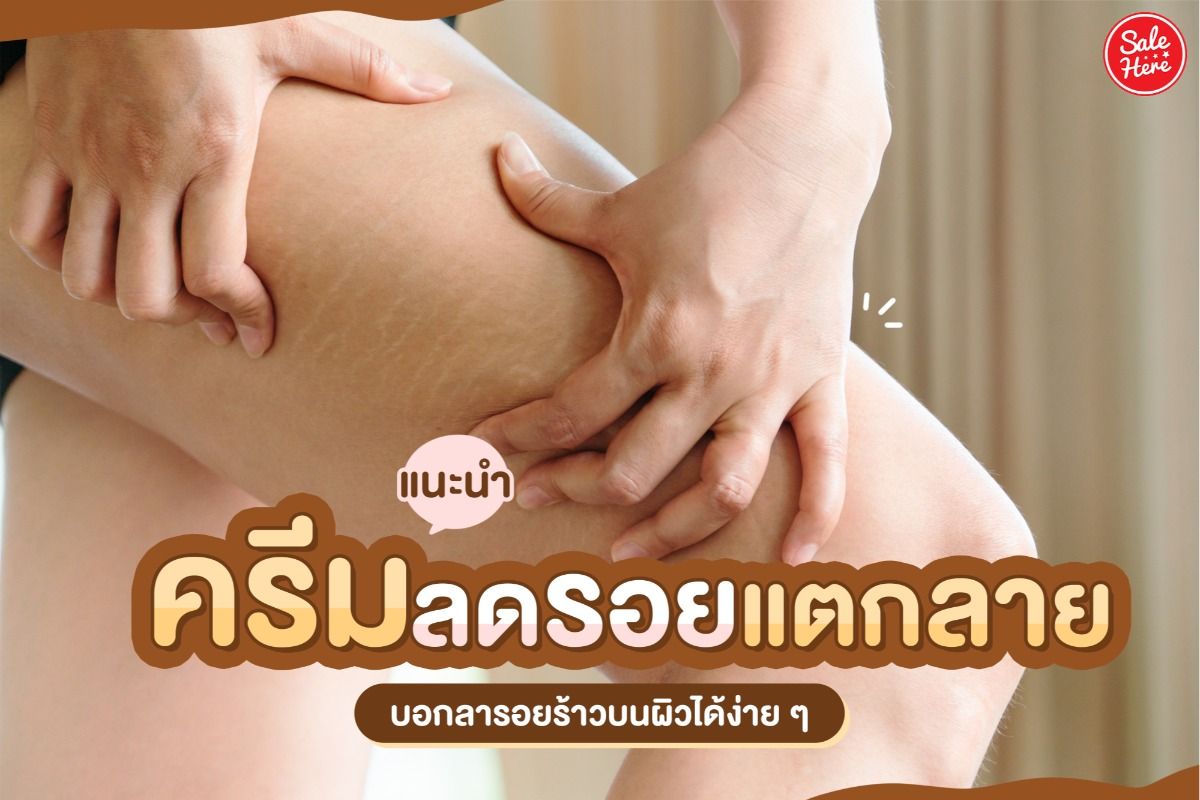 แนะนำครีมลดรอยแตกลาย บอกลารอยร้าวบนผิวได้ง่าย ๆ - Sale Here