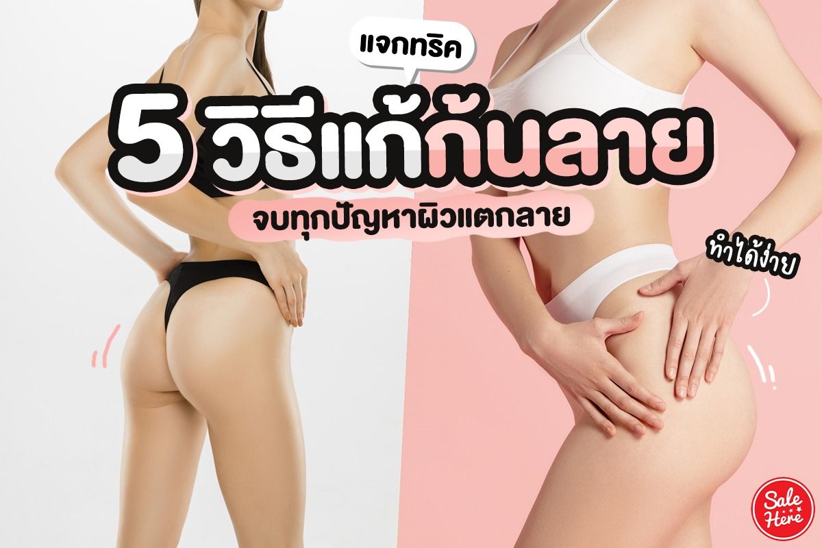 แจกทริค 5 วิธีแก้ก้นลาย ทำได้ง่าย จบทุกปัญหาผิวแตกลาย - Sale Here